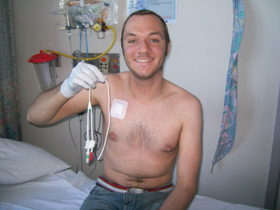 Hickman Line